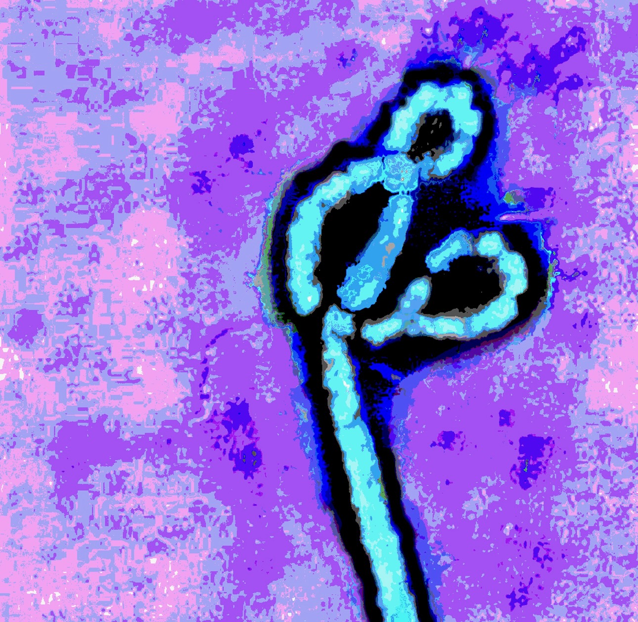 Ebola Outbreak